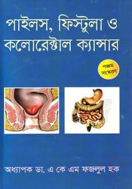 পাইলস ফিস্টুলা ও কলোরেক্টাল ক্যান্সার